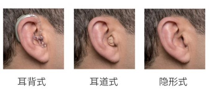 耳内式助听器佩戴效果图